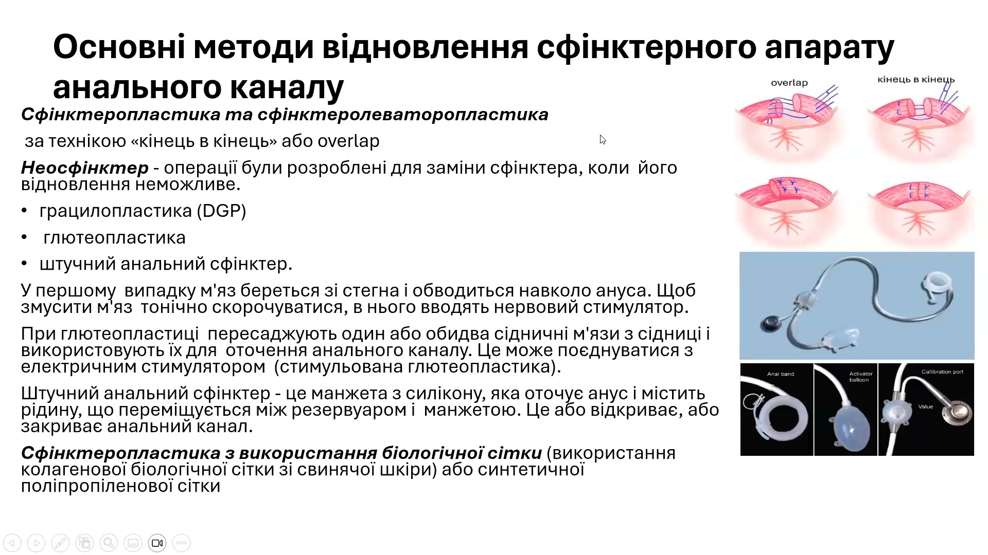 Реконструкція бойових ушкоджень анального сфінктера: техніки, оцінка та клінічні випадки
